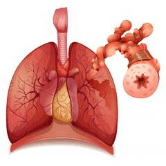 astma och allergier